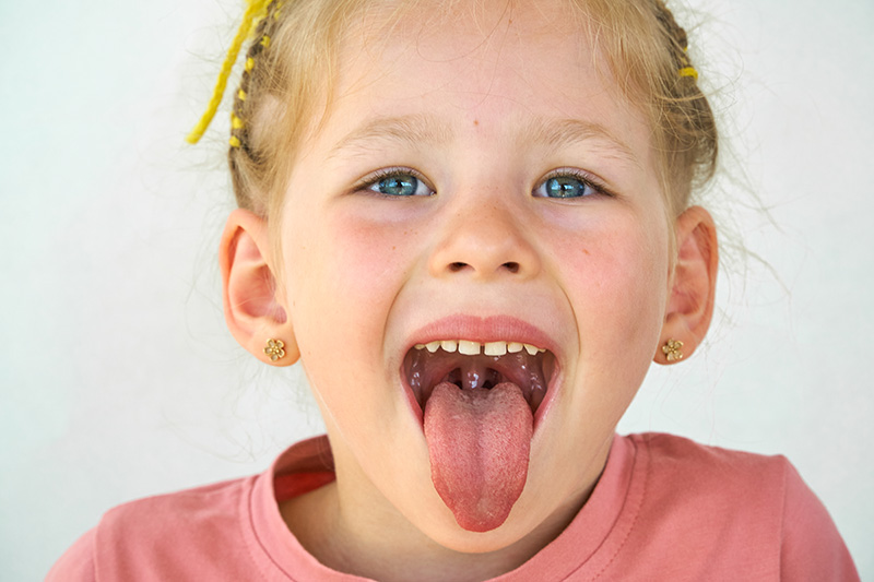 Understanding Tongue Thrust | Chicago Speech Therapy